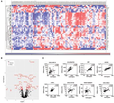 Fatigue in Sjögren's Syndrome: A Search for Biomarkers and Treatment Targets